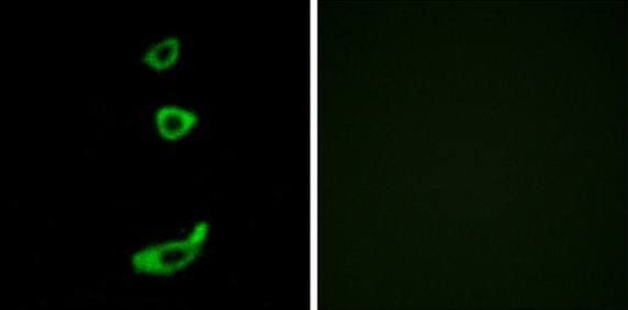 CRHR1 antibody