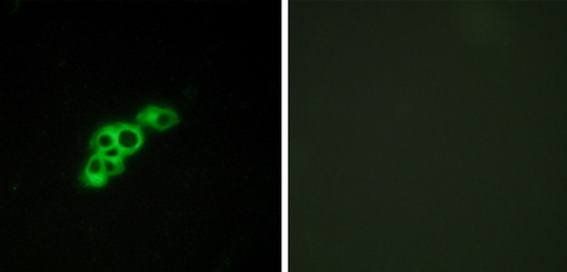 FSHR Antibody