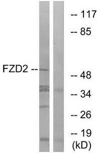 FZD2 antibody