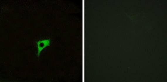 CHRM2 Antibody