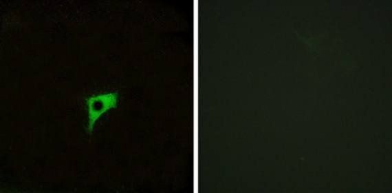 CHRM2 antibody