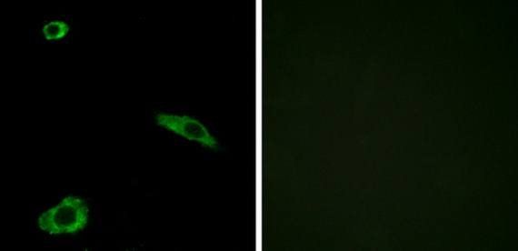 ACTHR Antibody