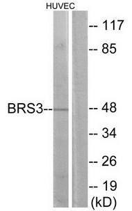 BRS3 antibody