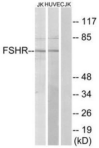 FSHR antibody