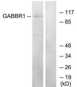 GABBR1 antibody