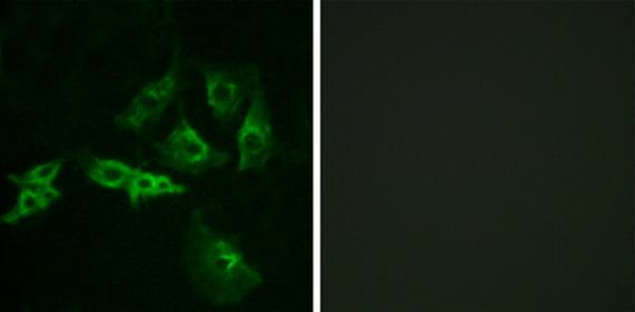 GNRHR antibody