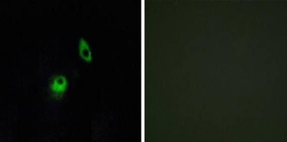 GPR124 Antibody