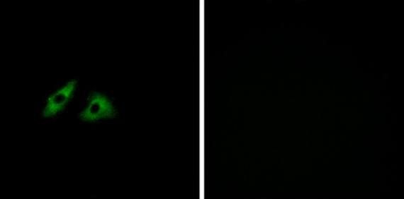 GPR152 Antibody