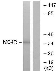 MC4R antibody