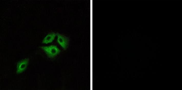 NMBR Antibody