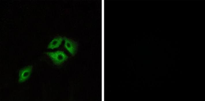 NMBR antibody