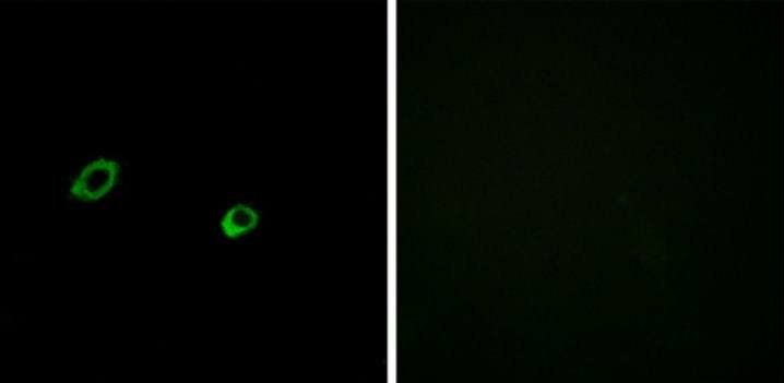 OR10AG1 Antibody