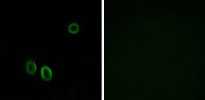 OR51E1 antibody