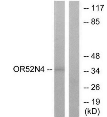 OR52N4 antibody