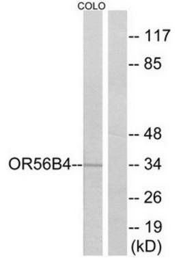 OR56B4 antibody