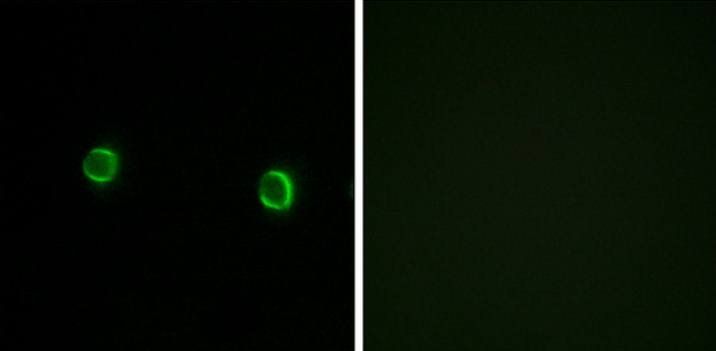 OR5AS1 Antibody