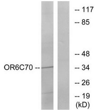 OR6C70 antibody