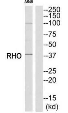 RHO antibody