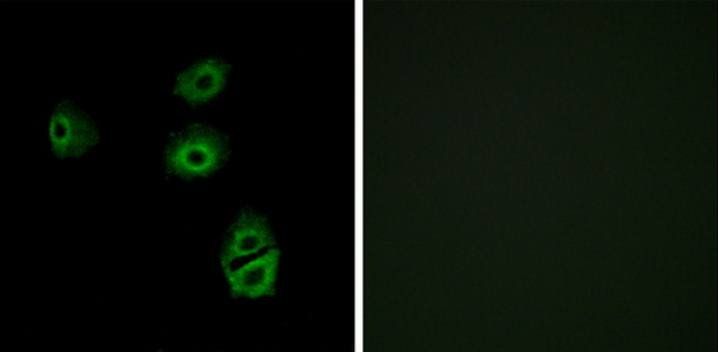 OR2B2 Antibody
