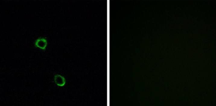 OR2M2 Antibody
