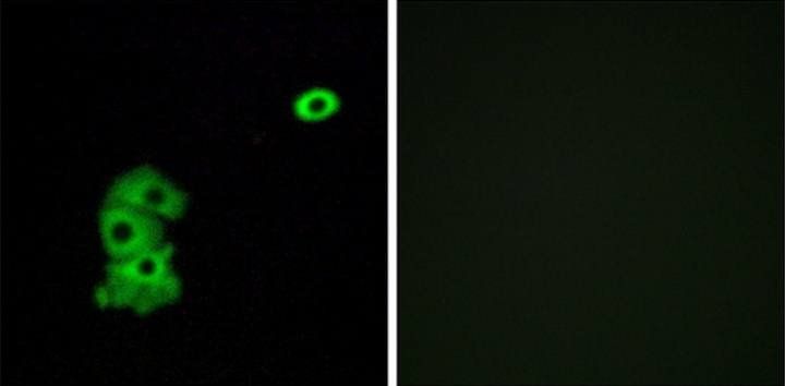 OR4C6 Antibody
