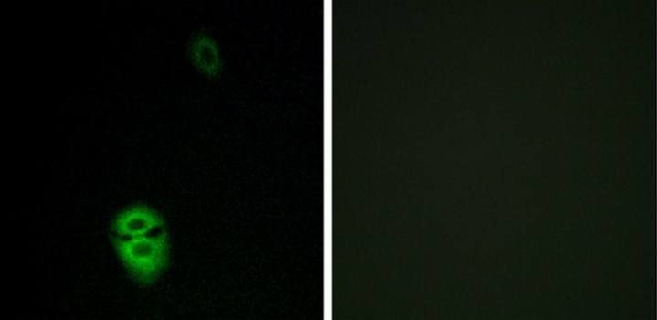 OR4K17 Antibody