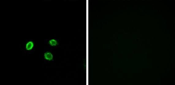 OR5M9 Antibody