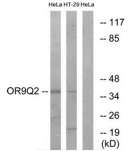 OR9Q2 Antibody