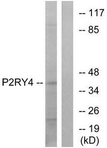 P2RY4 antibody