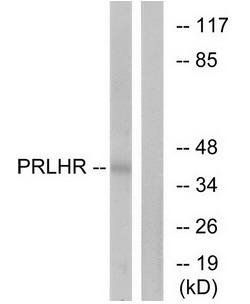 PRLHR antibody