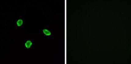 SSTR1 antibody