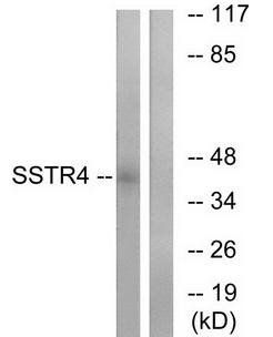 SSTR4 antibody