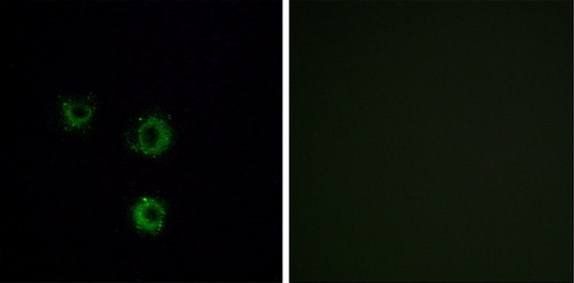 TAS2R14 Antibody