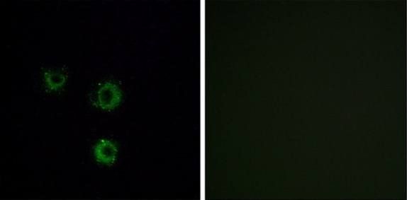 TAS2R14 antibody