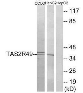 TAS2R49 antibody