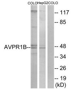 AVPR1B antibody