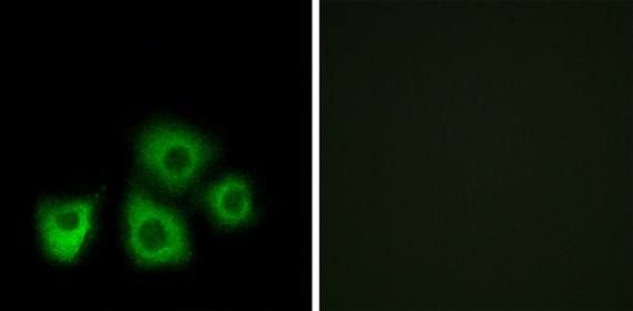 OR5M1/5M10 Antibody