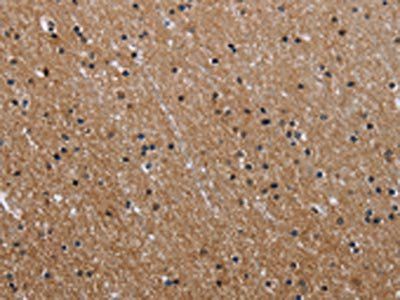 GAB2 Antibody