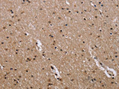 GAB2 Antibody