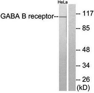 GABA-B Receptor antibody
