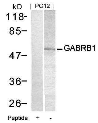 GABRB1 (Ab-434) Antibody