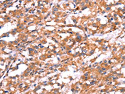 GABBR1 Antibody