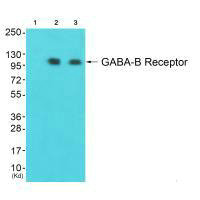 GABBR1 antibody