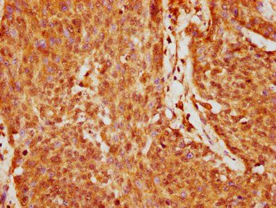 GABPA Antibody