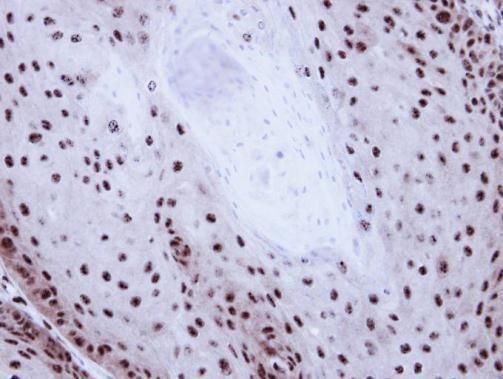 GABPB1 Rabbit Polyclonal Antibody