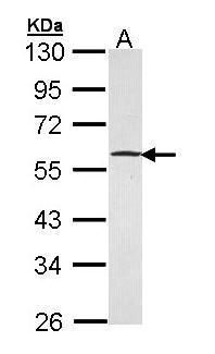 GABPB1 Rabbit Polyclonal Antibody