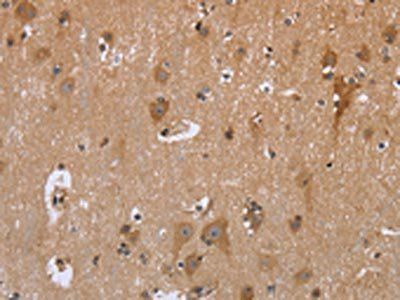 GABPB2 Antibody