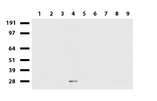 GABPB2 (GABPB1) antibody