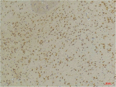 GABRA3 antibody