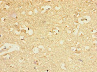 GABRA5 Antibody